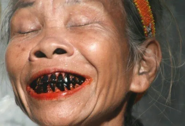 An older woman with black teeth in a smile.